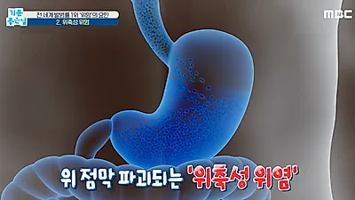 위에서 발생하는 악성종양
