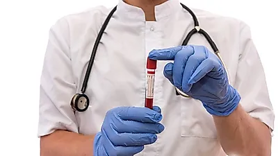 이것 한 방울만 있으면 전립선암 진단할 수 있다