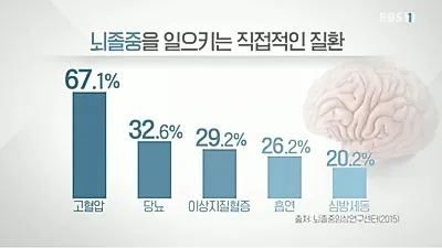 뇌출혈 수술 후 생존율 및 사망률은? (+후유증)