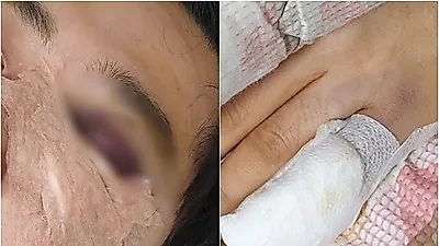 "예비 신랑이 층간소음으로 폭행을 당했습니다"(+ 사진有)
