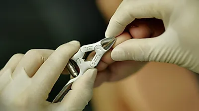 고통스러운 내성발톱, 자가치료 가능하다? (+원인,증상)