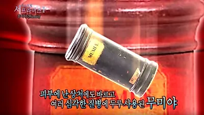 만병통치약, 알고보니 사람 OO으로 만들어져