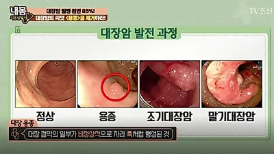 이 증상도