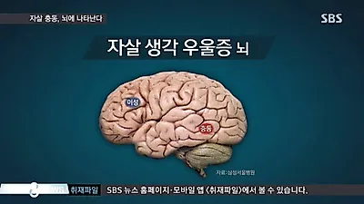 우울증 증상인가? 자가진단하기 (+테스트)