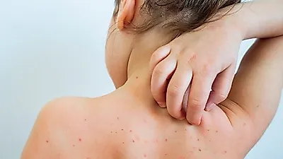 극한 고통