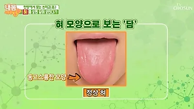 자, 메롱~해보세요 (feat. 혓바닥 건강)