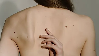 “저체중도 건강에 위협적” 건강하게 살 찌우는 법