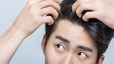 제발 난방 틀지마,, 속당김 장난 아닌 두피 건조증