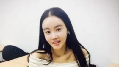 탈모인 1000만 시대, 여성 탈모 원인 및 초기 치료법