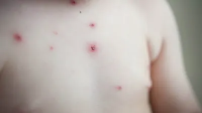 일상에서 몸속 독소 해독하는 쉬운 방법 (+음식)
